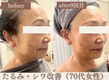 スリーエッセンス(3THREE ESSENCE)