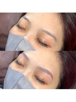 アンベリール(embellir)/ハリウッドブロウリフト(HBL)