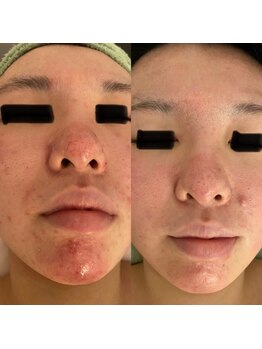 エリシアン ビューティーサロン(Elysian)/