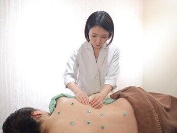 メイロン(meilong)の写真/つわりや腰痛などをやわらげ、妊娠期間を快適に過ごしながら出産したい女性に人気なマタニティ鍼灸です◎