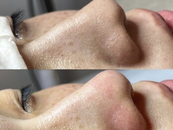 エヌエクラ(N.eclat.)/鼻