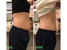 柏の葉オレンジ整体院/お腹ぽっこりが・・・♪