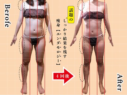 アマンシィ(Amincir)の写真