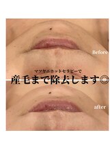 サロン ド リリー(salon de lily)/マツヤニホットセラピー