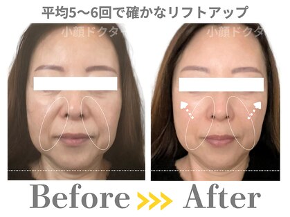 小顔ドクターの写真