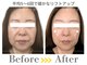 小顔ドクターの写真