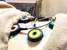 仁接骨院 じん鍼灸治療院/胃腸ケア鍼灸