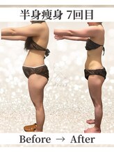 ドレス(dress)/半身痩身Before/After