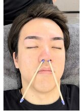 サムライビューティー 新宿三丁目店(SamuraiBeauty)/ 鼻毛ワックス☆1650円！