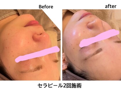 エンネ(En’ne)の写真