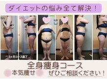 ダイエット サポート(DIET SUPPORT)