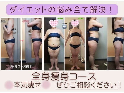 ダイエット サポート(DIET SUPPORT)の写真