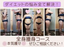ダイエット サポート(DIET SUPPORT)