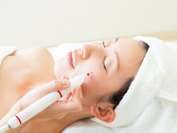 スキンケアガーデン カロン(SkinCaregarden Kalon)の写真/【県内初導入】次世代シミケア機で諦めていたシミ悩みもお任せ！最新技術で最高の美肌へ♪