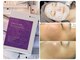 エスボーテ(sbeaute)の写真/またできた…」を卒業。20,000ppmで叶えるニキビゼロ肌。
