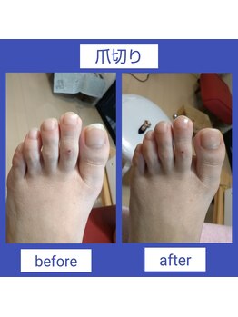 ドクターネイル爪革命 三郷店/爪切りケア