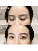 アイリー(IRIE)/HBL＋LASH LIFT