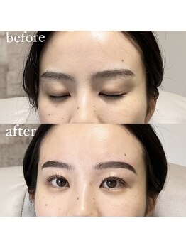 アイリー(IRIE)/HBL＋LASH LIFT
