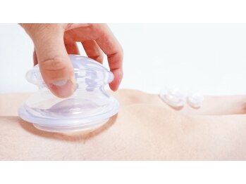 お花茶屋駅前整体院/スッキリ！スライドカッピング☆