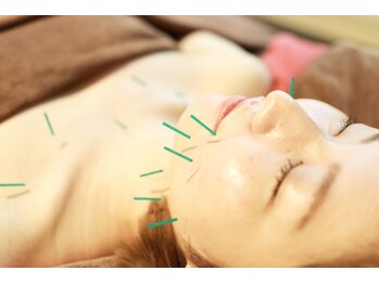 やなけん 亀戸店/美容鍼/小顔/エラ/食いしばり