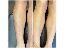 リーズン(LEASON)の雰囲気（小学生から大人まで♪親子で通える、低価格&都度払いエステ脱毛!）