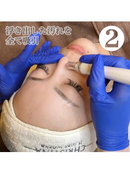 トータルビューティーサロン ルース(LUZ)/毛穴洗浄