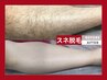 【美肌効果＆長期間効果持続】全身脱毛★都度払いモニター35,000円→15,500円