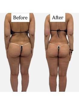 ラヴィ(Ravi)/美尻美脚コース60分