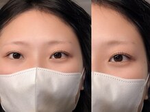 エクラ(Eclat)/まつ毛パーマ/パリジェンヌ