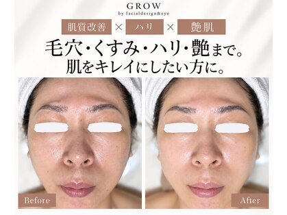 グロウ バイ フェイシャルデザイン アンド アイ(GROW)の写真