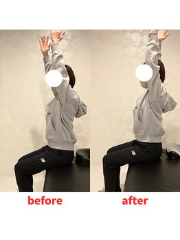 ナオル整体 福岡香椎院(NAORU整体)/40代女性施術事例【肩こり】