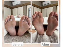 フウカ(Fuka)の雰囲気（固まった足裏をゆるめて、滞っていた血流をスムーズに。）
