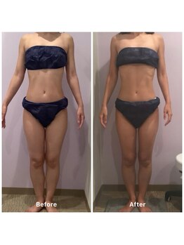 ナレル(narrel)/(新潟市/骨盤/痩身/ダイエット)