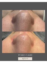アルメ(arme)/【毛穴ケア】