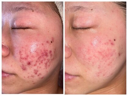 ブレアドール(Blair-Doll)の写真