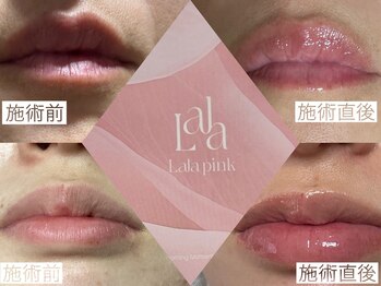 ココラッシュ(coco.lash)