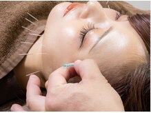 【小顔・肌質・たるみ・シミに】美容鍼灸×矯正×フェイシャル◎