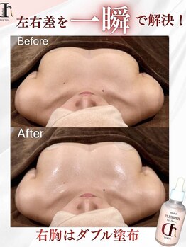 キャニー(cany)/左右差が気になる方はコレ！！