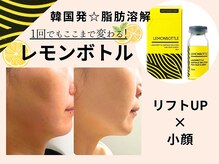 クラルテ(CLARTE)の雰囲気（たるみ/フェイスラインのもたつきに◎即効性を求める方にも◎）