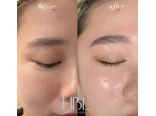 シエル(ciel)/ビフォー→アフター