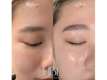 シエル(ciel)/ビフォー→アフター