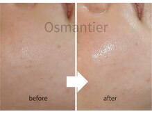 オスマンティエ(Osmantier)の雰囲気（韓国発バクチオールピール（カボチャピール）で自然な発光肌へ）