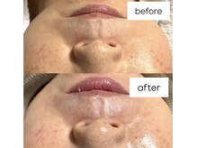 エリュレ(Elyure)/セラピール