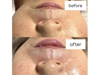 エリュレ(Elyure)/セラピール