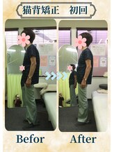 アミーゴ整体院/ビフォーアフター