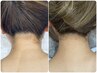 【ブライダル必見】うなじを美しくWax脱毛