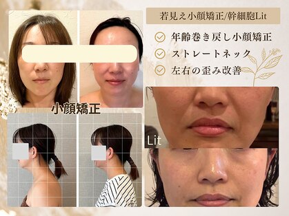 エミフル(emifull)の写真