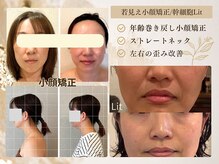 エミフル(emifull)