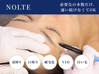 ノルテ(NOLTE)の写真
