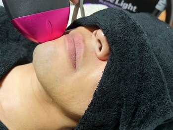 ルアナ(Luana)/LEDプラチナビーム脱毛♪